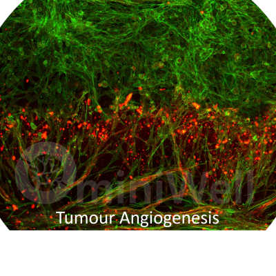 Angiogenesis